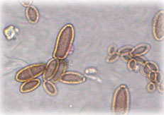 microscopic view of fungal spores in the shape of blobs