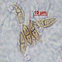 microscopic view of fungal spores in the shape of small fingers