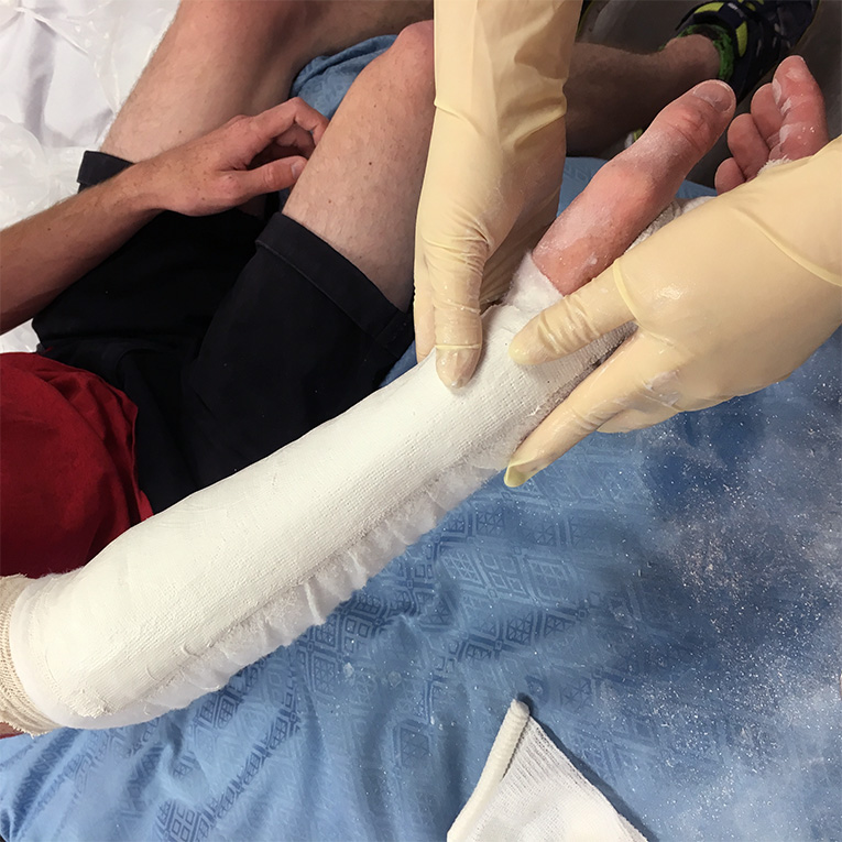 A physician associate student wraps another student's arm in a bandage as part of the physician associate course.