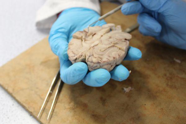 A close up of a person's gloved hands completing a brain dissection