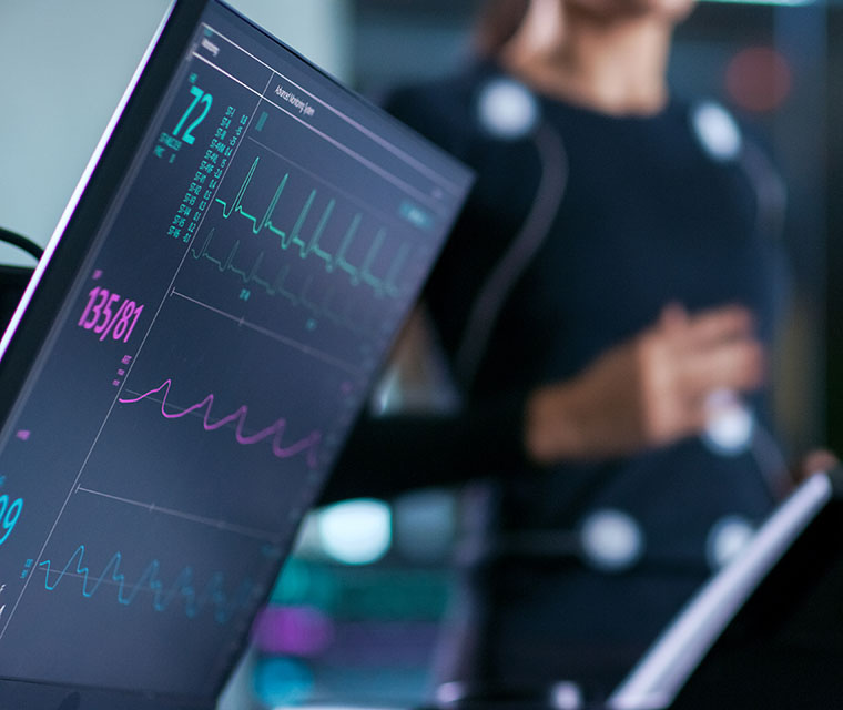 Monitor showing EKG reading of athlete running on a treadmill in the background